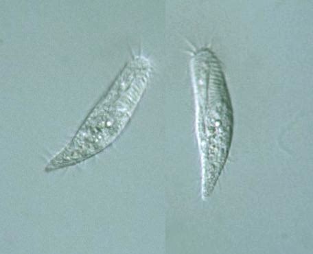  Uroleptus: Un piccolo gigante microscopico che si muove come un ballerino e fagocita le sue prede con gusto!