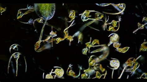  Ischnosphaera: This Microscopic Wanderer Will Leave You Wondering About the Wonders Hiding Within a Single Drop of Water!